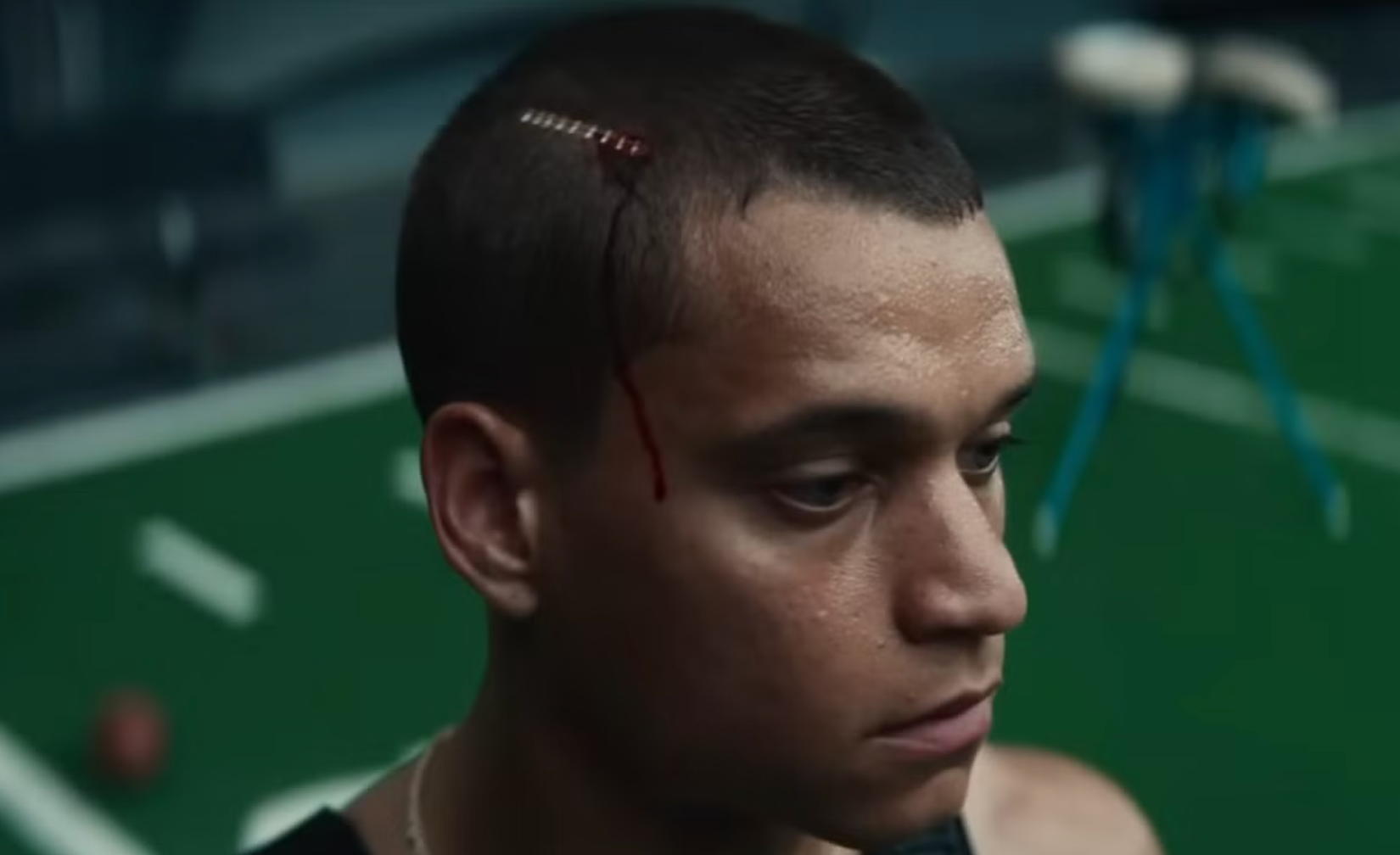 Cam's injured head with stitches in Him