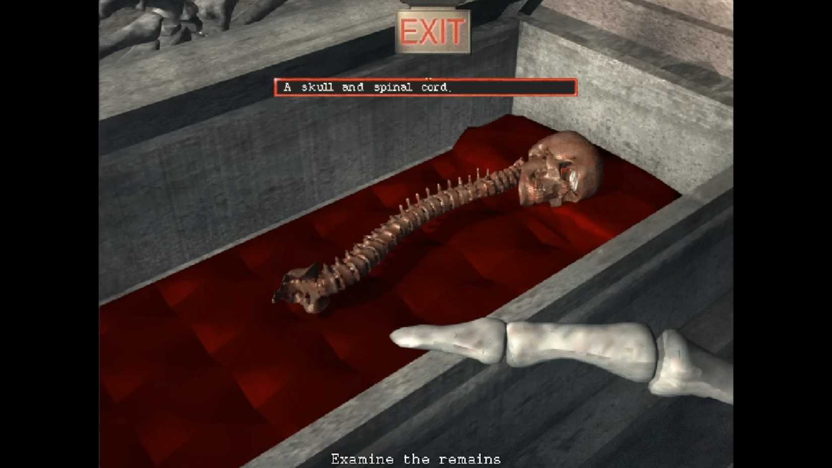 A skull with an attached spinal cord is discovered, with the player given the option to examine the remains.