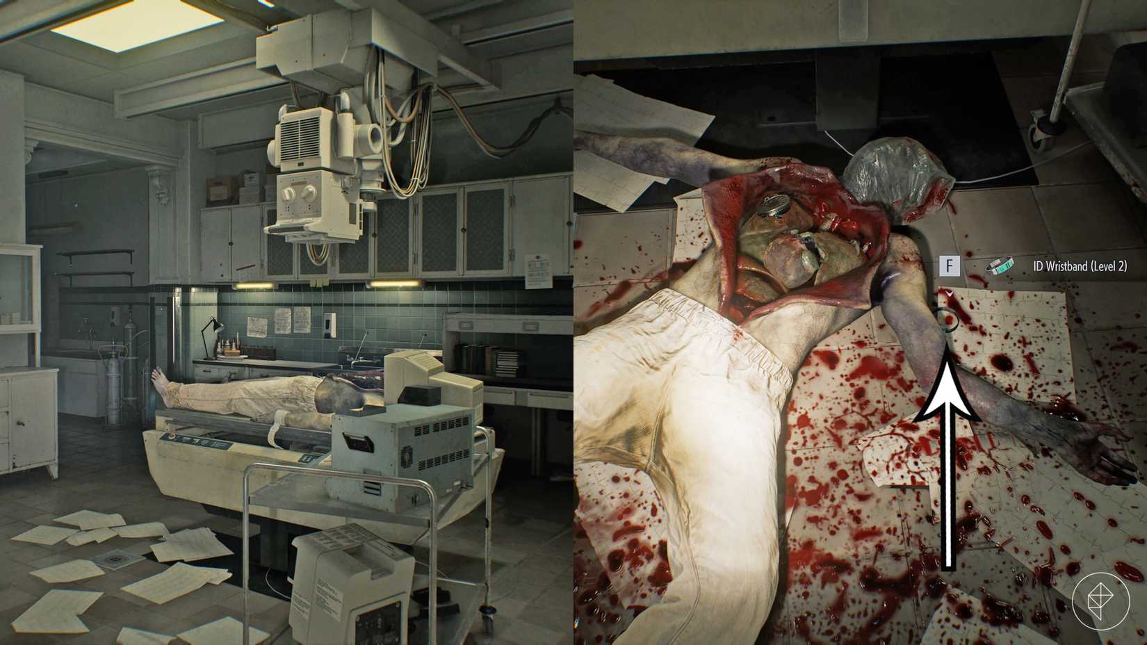 The organless corpse drops ID Wristband Level 2 in Resident Evil Requiem.