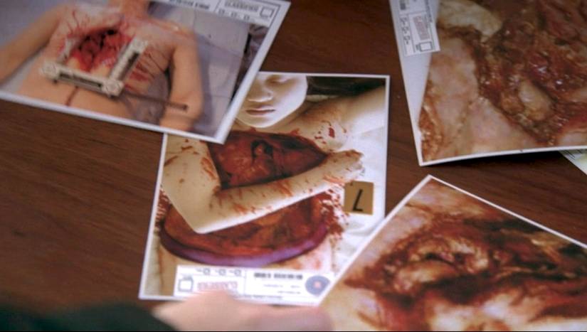 A group of photos of people with organs removed are laid on a table in the Fringe episode "Marionette"