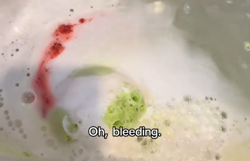 Yoshi bath egg bleeding