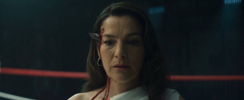 Vanessa Fisk con un fragmento de vidrio en la cabeza